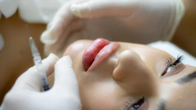 Этот день настал: инъекции филеров выходят из моды