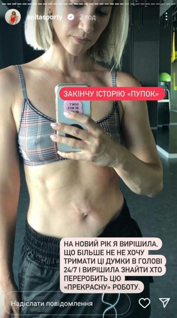 Аніта Луценко зробила пластику живота і показала відверті фото результату - фото 603118