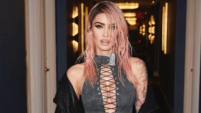 Меган Фокс перечислила все пластические операции, которые сделала в своей жизни