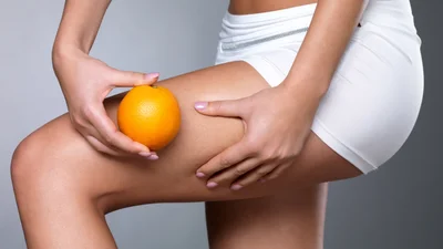 Фитнес-тренерка рассказала, какие упражнения надо делать, чтобы избавиться от целлюлита