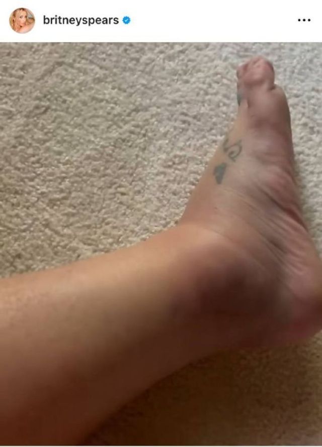 Брітні Спірс показала свою травмовану ногу - фото 611710