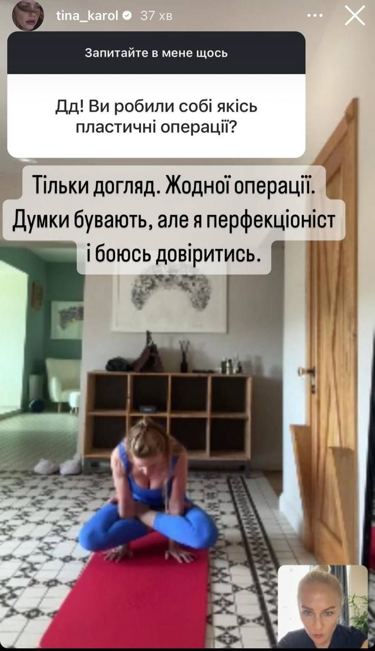 'Думки бувають', - Тіна Кароль щиро зізналася, чи робитиме пластику - 619288 'Думки бувають', - Тіна Кароль щиро зізналася, чи робитиме пластику - фото 619288