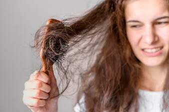 Чому випадає волосся: 5 неочевидних причин