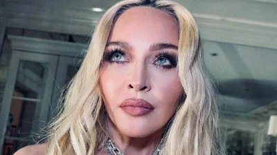 Мадонна відверто розповіла про свій стан: пройшов рік після страшної історії зі здоров'ям