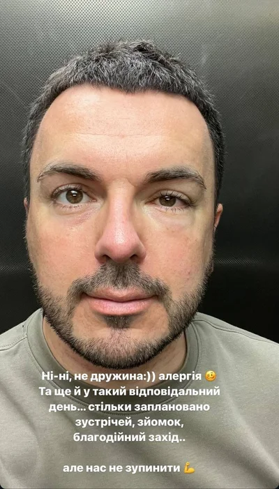 'Ні, не дружина', - Григорій Решетнік налякав розпухлим обличчям й розповів, що сталося - фото 623388