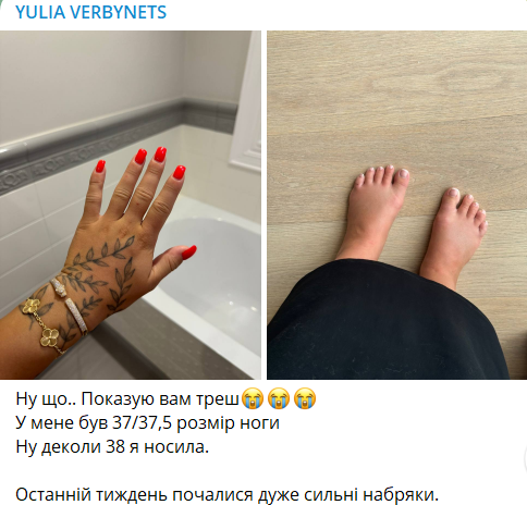 Беременная Юля Верба призналась, сколько уже набрала килограммов в ожидании ребенка - 628392 Беременная Юля Верба призналась, сколько уже набрала килограммов в ожидании ребенка - фото 628392
