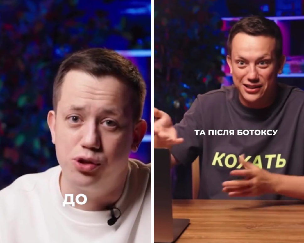 Алексей Дурнев смеялся над Тищенко, а потом сам вколол ботокс - 636193 Алексей Дурнев смеялся над Тищенко, а потом сам вколол ботокс - фото 636193