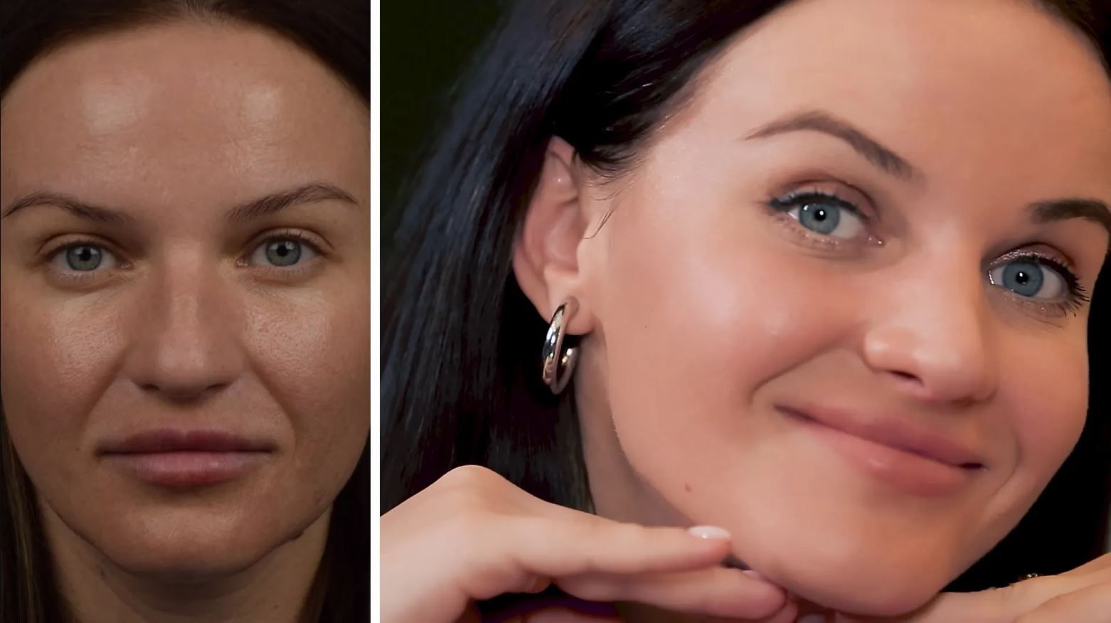 Из-за здоровья и эстетики: Алина Доротюк призналась о ринопластике и уменьшении груди - фото 639968