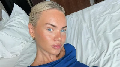 Опалювальний сезон: 5 важливих правил догляду за шкірою взимку