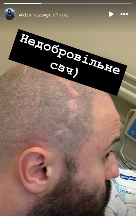 'Недобровільне СЗЧ': Виктор Розовый показал, как сейчас выглядят шрамы на голове - фото 664010