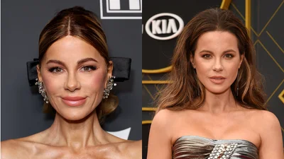 Несподівані зміни: найневдаліші б'юті-трансформації 2024 року від Кейт Бекінсейл до Раяна Гослінга