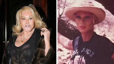 Померла відома "жінка-кішка" Джоселін Вільденштейн, яка зробила 80 пластичних операцій