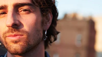 Володимир Дантес похизувався результатом б'юті-процедури, на яку наважився