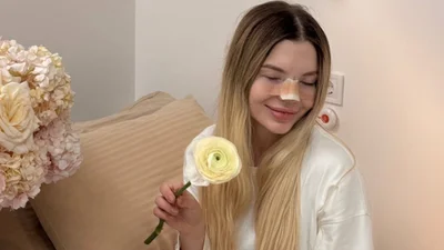 Скальницька пробула 6 годин в лікарні і вийшла з новим носом - фото