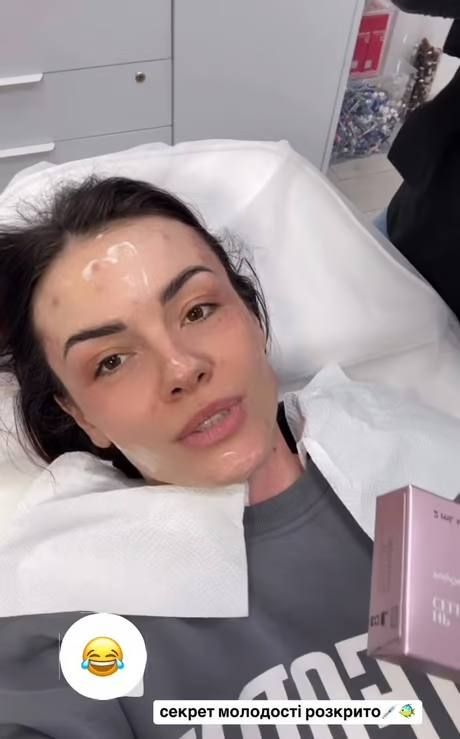 MamaRika уколола себе в лицо 'кое-что отвратительное' от лосося, чтобы омолодиться - фото 679986