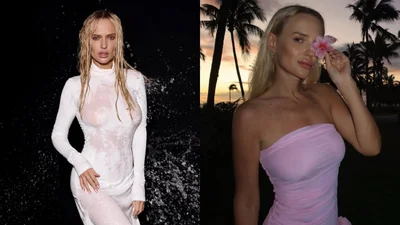 Готочкина сделала операцию и показала, что ей подарил Тарас Цимбалюк