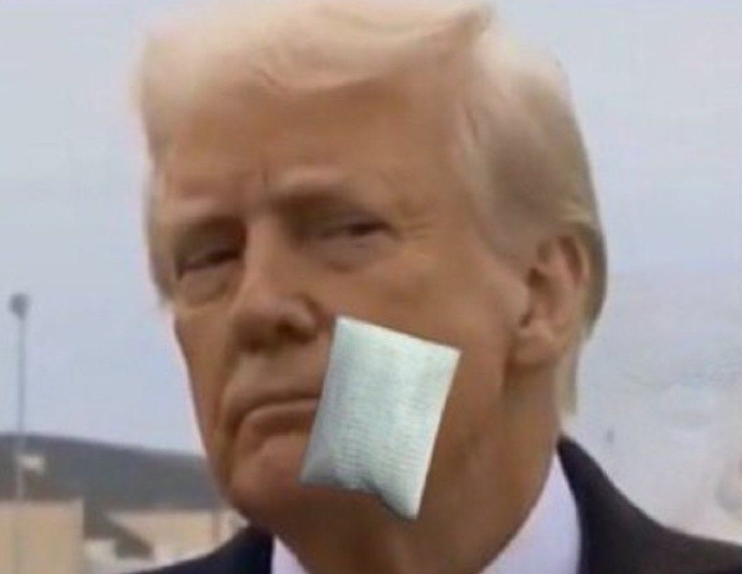 Дональд Трамп отримав мікрофоном по обличчю, і це потрапило в прямий етер - 697881 Дональд Трамп отримав мікрофоном по обличчю, і це потрапило в прямий етер - фото 697881