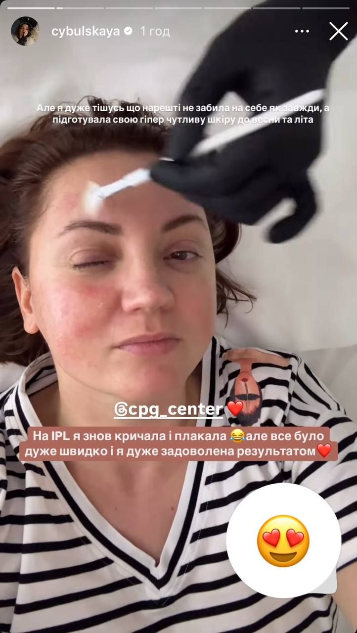 Оля Цибульская решилась омолодить лицо - все прошло со слезами и матом - фото 698536