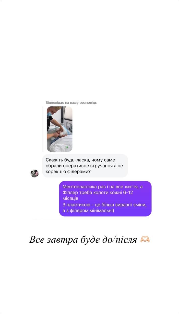 Катя Репяхова сделала пластическую операцию на лице - смотри, как теперь выглядит жена Павлика - 701999 Катя Репяхова сделала пластическую операцию на лице - смотри, как теперь выглядит жена Павлика - фото 701999