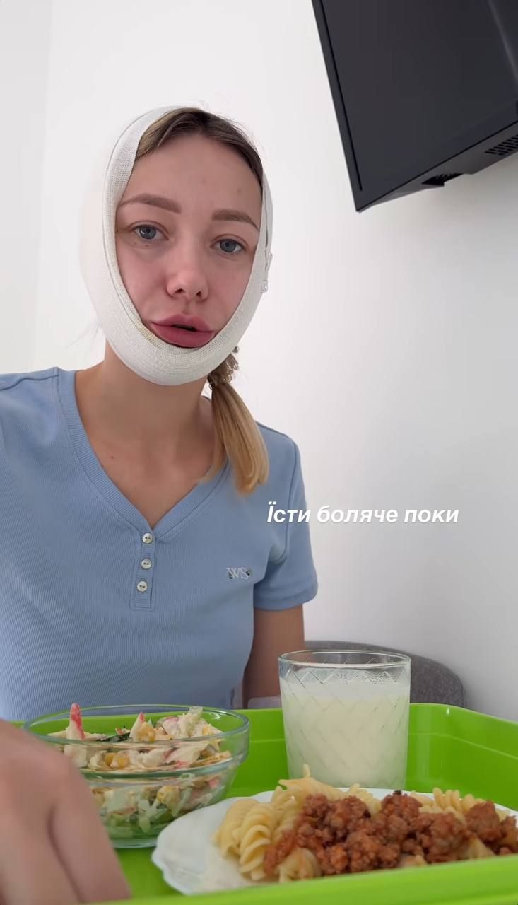 Катя Репяхова сделала пластическую операцию на лице - смотри, как теперь выглядит жена Павлика - 702001 Катя Репяхова сделала пластическую операцию на лице - смотри, как теперь выглядит жена Павлика - фото 702001