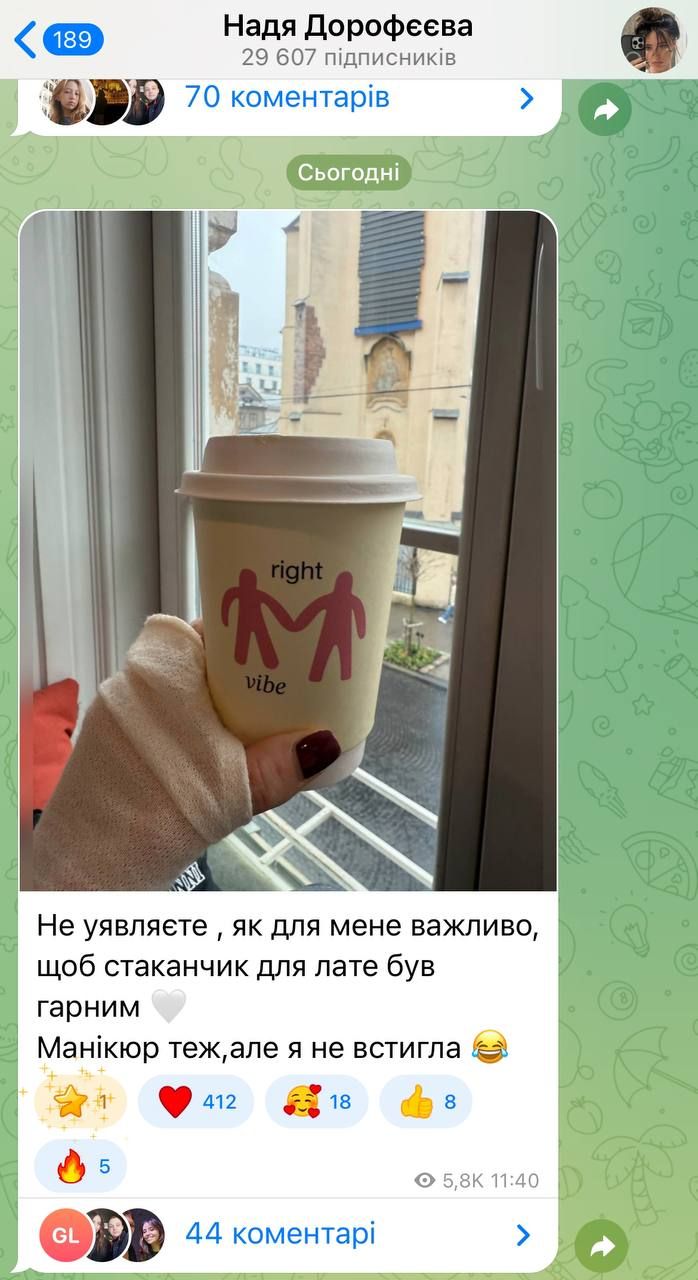 Надя Дорофеева засветила неухоженный маникюр, рассказывая о необычной прихоти - 703139 Надя Дорофеева засветила неухоженный маникюр, рассказывая о необычной прихоти - фото 703139