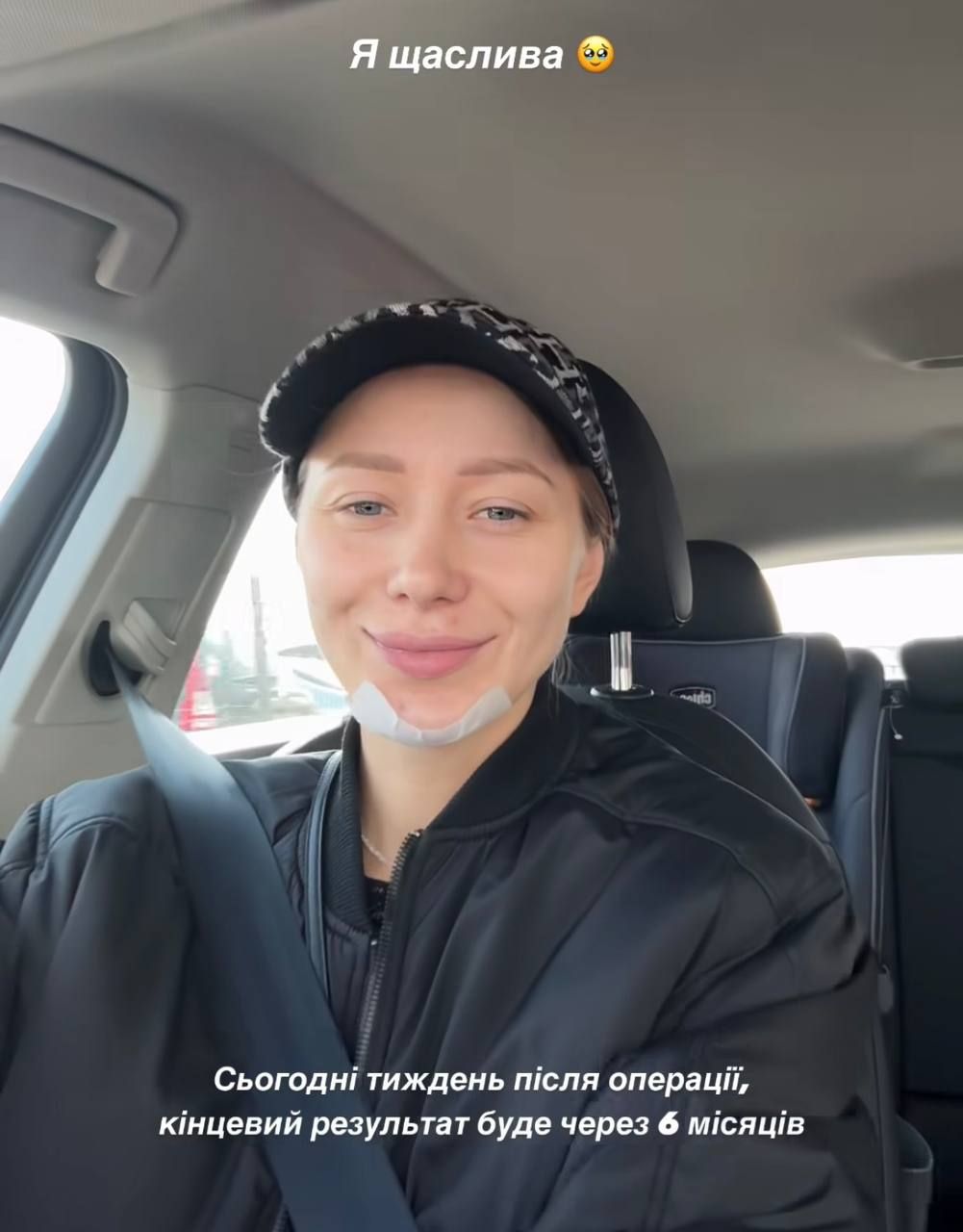 Дружина Віктора Павліка розповіла, чи подобається їй обличчя після операції - 704301 Жена Виктора Павлика рассказала, нравится ли ей лицо после операции - фото 704301