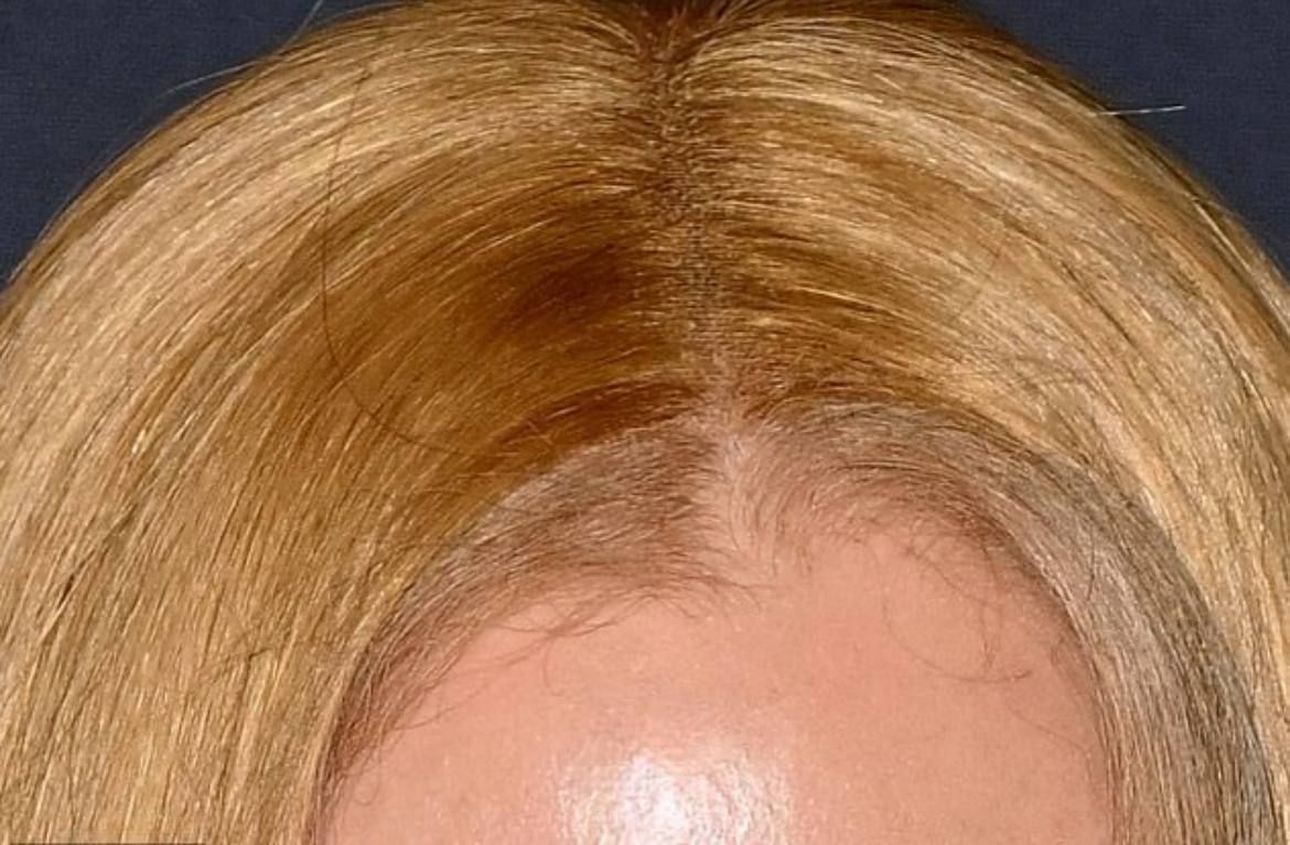 У Николь Кидман спал парик на красной дорожке, а она и глазом не моргнула - 720266 У Николь Кидман спал парик на красной дорожке, а она и глазом не моргнула - фото 720266