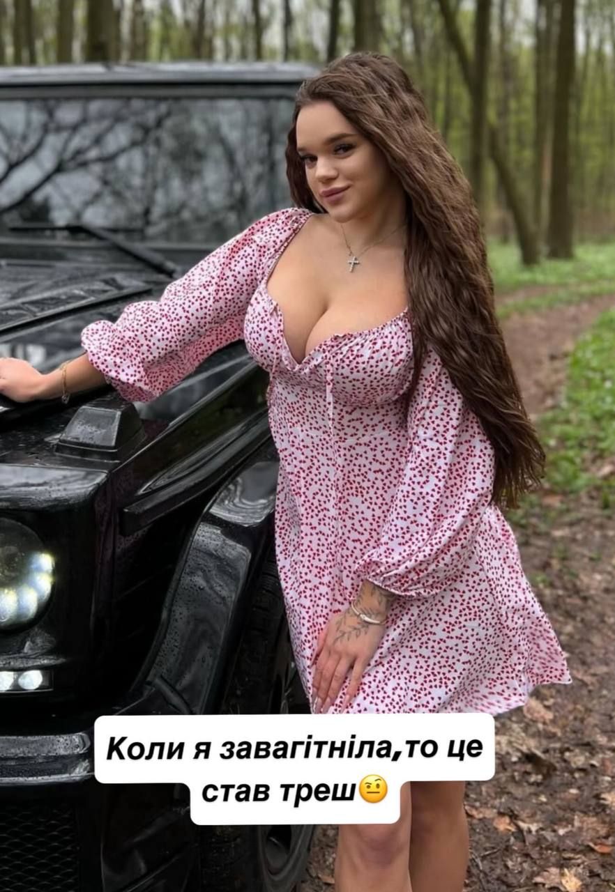 Верба сделала подтяжку груди и пережила самые болезненные дни жизни - смотри фото до и после операции - фото 725158
