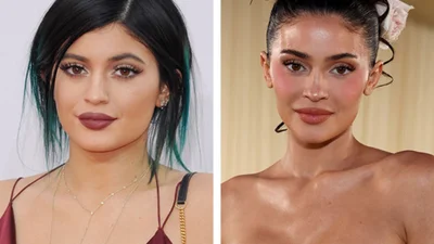 До и после пластики: невероятные трансформации известных красавиц