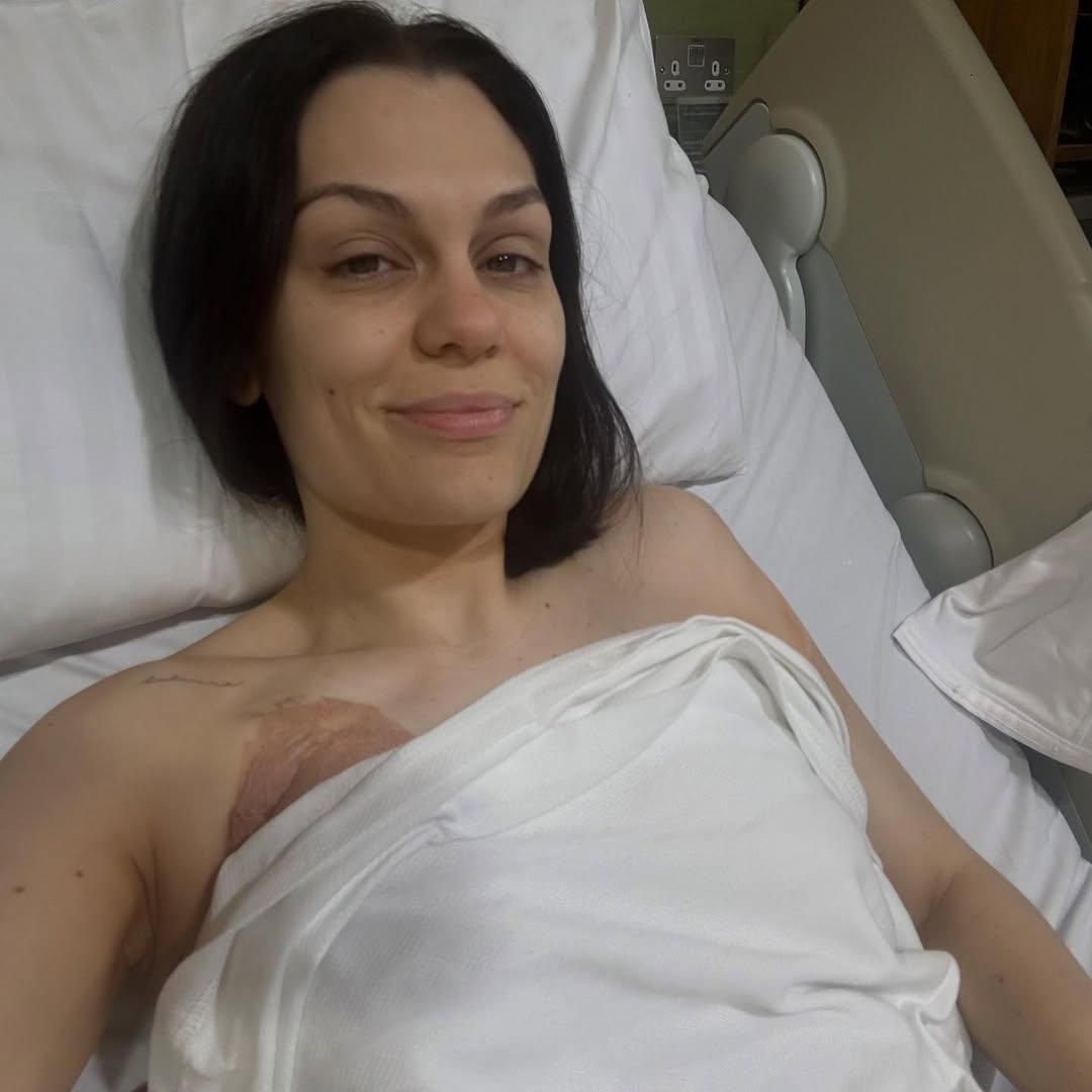 Онкохворій Jessie J зробили першу операцію: який нині вигляд має співачка - 739220 Онкохворій Jessie J зробили першу операцію: який нині вигляд має співачка - фото 739220