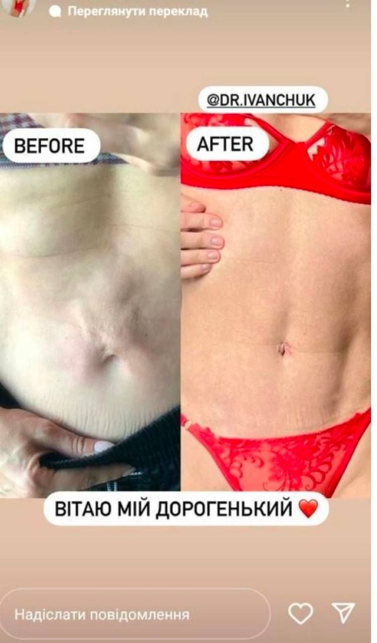 Аніта Луценко і пластика - фото 745880