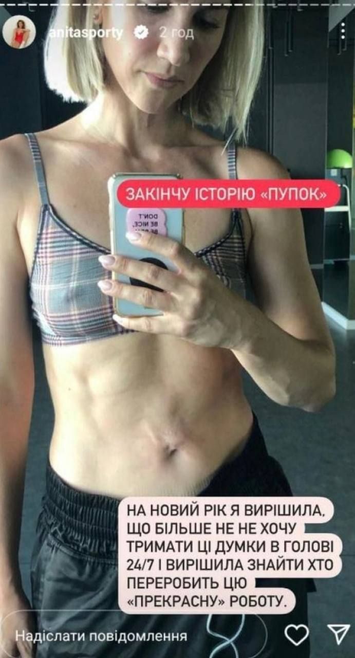 Аніта Луценко і невдала пластика - фото 745881