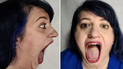 Женщина прославилась и установила мировой рекорд - ее челюсть открывается шире, чем ты можешь представить