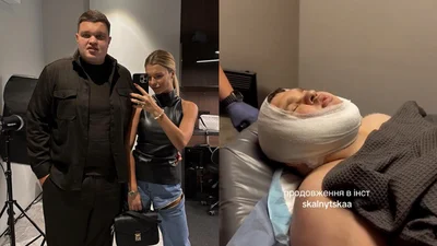 Муж Скальницкой похудел на 20 кг и сделал подтяжку тела - как он выглядит сейчас