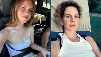 Лана Дель Рей ответила на слухи о пластике и призналась, что на самом деле сделала