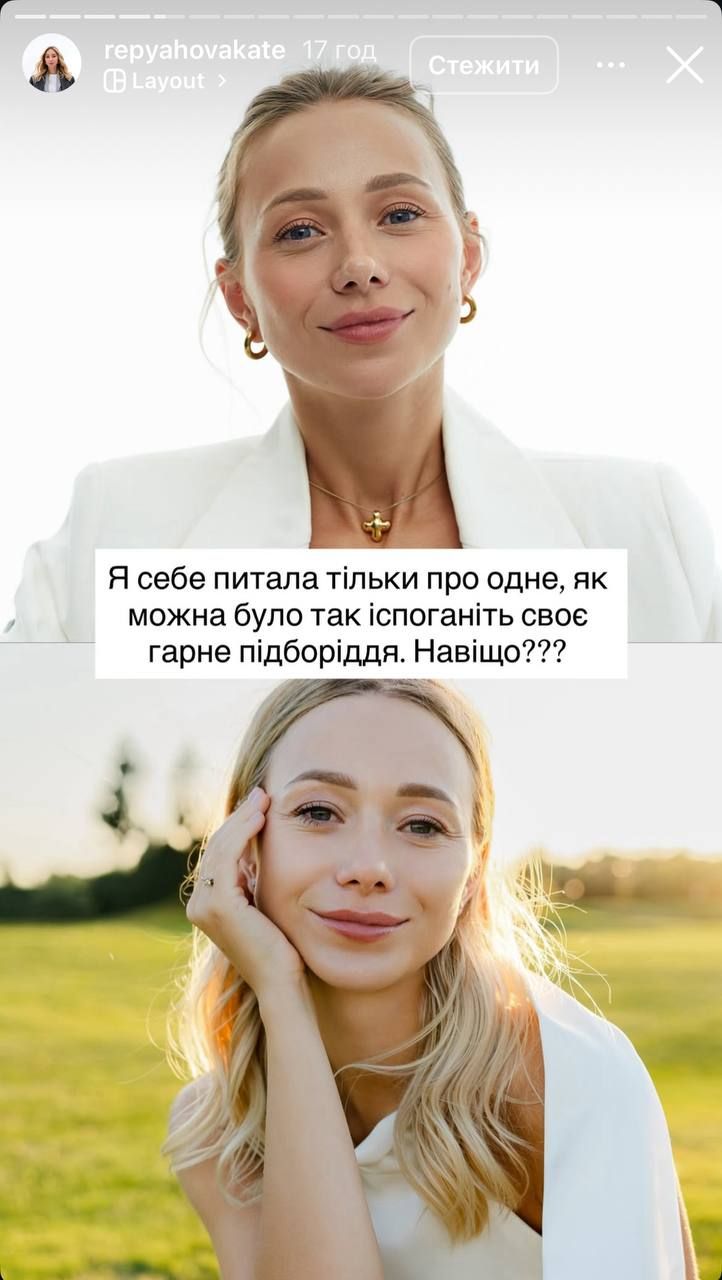 Катерина Репяхова показала, як виглядала 'до' та 'після' пластики. - 774296 Катерина Репяхова показала, як виглядала 'до' та 'після' пластики. - фото 774296