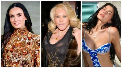 Звезды с самой дорогой пластикой в мире: на фото до и после их невозможно узнать