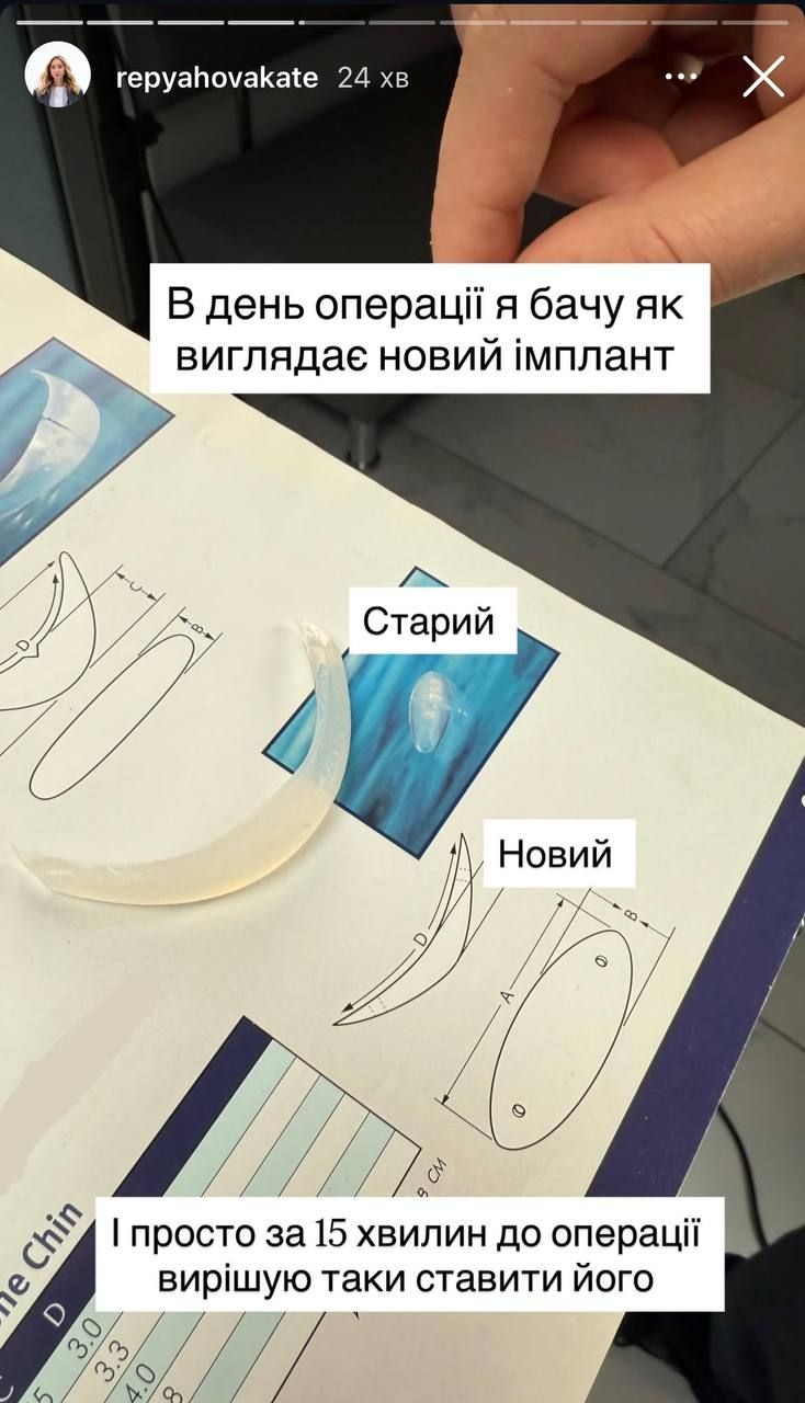 Жена Виктора Павлика сделала 3 новые операции после неудачной пластики: фото до и после - 774813 Жена Виктора Павлика сделала 3 новые операции после неудачной пластики: фото до и после - фото 774813