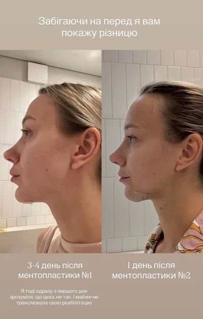 Katya Repyakhova before and after plastic surgery - photo 774817