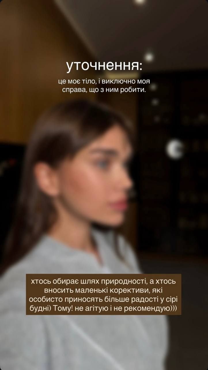 'Я подбала про себе': Саша Бо зробила підтяжку обличчя і відповіла хейтерам про свій набряк - 782747 'Я подбала про себе': Саша Бо зробила підтяжку обличчя і відповіла хейтерам про свій набряк - фото 782747