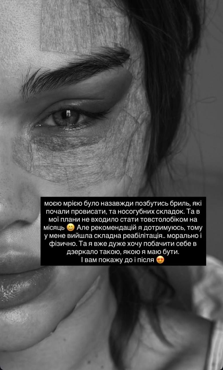 'Я подбала про себе': Саша Бо зробила підтяжку обличчя і відповіла хейтерам про свій набряк - 782748 'Я подбала про себе': Саша Бо зробила підтяжку обличчя і відповіла хейтерам про свій набряк - фото 782748