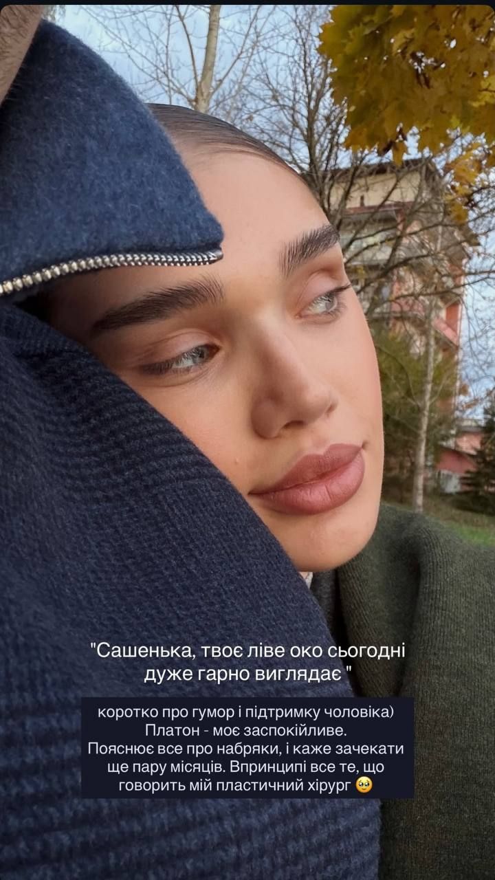 'Я подбала про себе': Саша Бо зробила підтяжку обличчя і відповіла хейтерам про свій набряк - 782751 'Я подбала про себе': Саша Бо зробила підтяжку обличчя і відповіла хейтерам про свій набряк - фото 782751