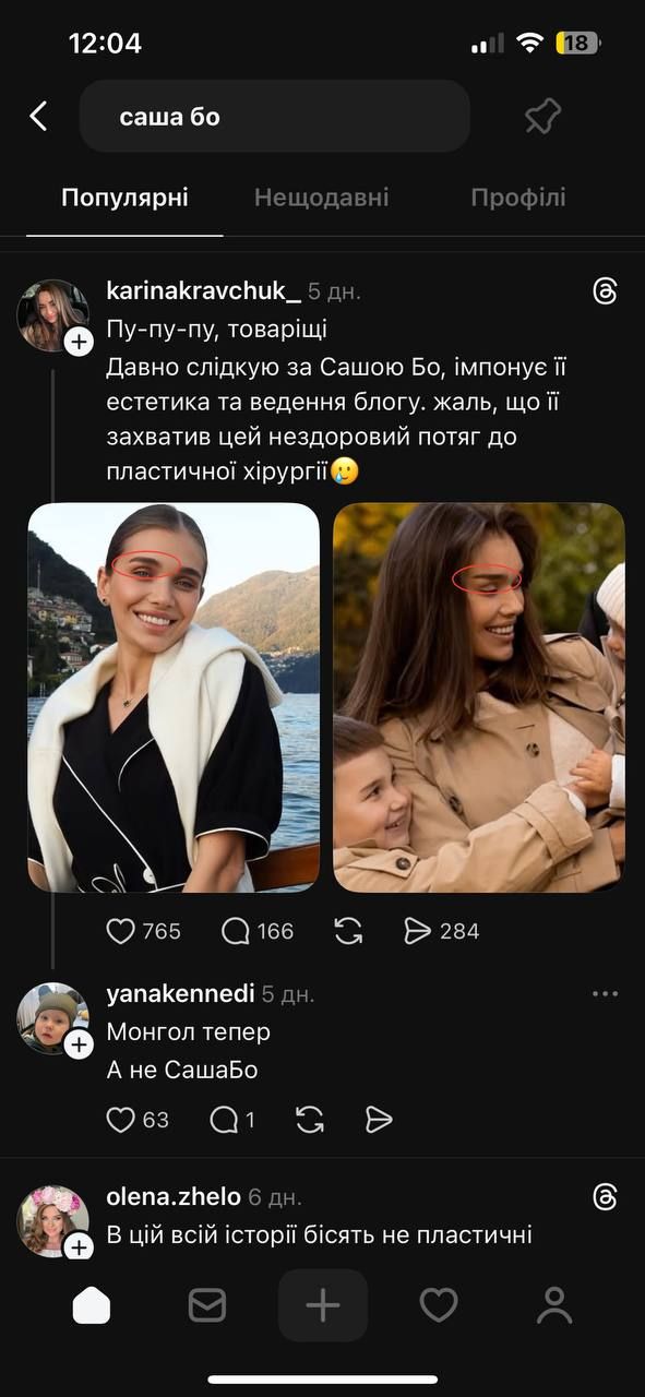 'Я подбала про себе': Саша Бо зробила підтяжку обличчя і відповіла хейтерам про свій набряк - 782772 'Я подбала про себе': Саша Бо зробила підтяжку обличчя і відповіла хейтерам про свій набряк - фото 782772