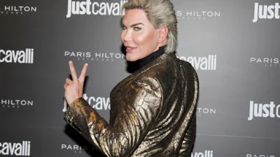 Как сейчас выглядит живой Кен, который перенес сотни операций и стал Барби – фото до и после смены пола