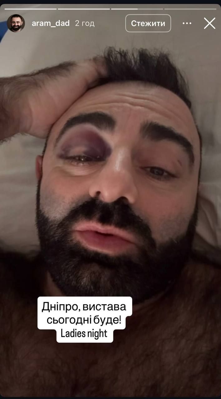 Арам Арзуманян рухнул в оркестровую яму во время спектакля: его забрали в больницу - фото - 794143 Арам Арзуманян рухнул в оркестровую яму во время спектакля: его забрали в больницу - фото - фото 794143