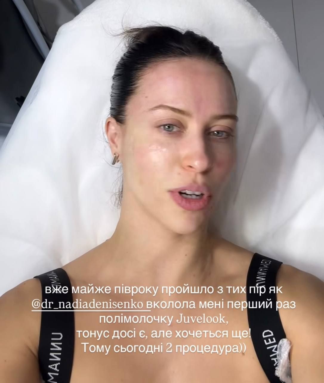 Виктория Маремуха рассекретила, какие уколы красоты делает –и их действительно много - фото 795135