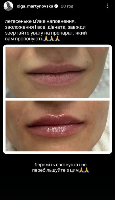 Ольга Мартиновська що робить з обличчям - фото 798864
