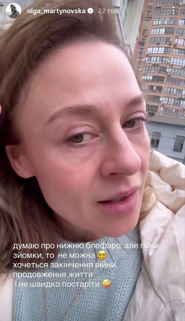 Ольга Мартиновська яку пластичну операцію зробила і хоче ще - фото 798865
