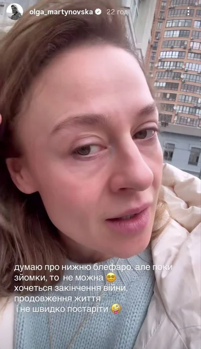 Ольга Мартиновська яку пластичну операцію зробила і хоче ще - фото 798865
