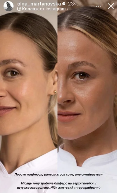 Ольга Мартиновська і пластика — що робить зі своїм обличчям суддя МастерШеф - фото 798866